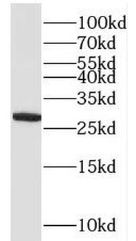 QDPR Rabbit Polyclonal Antibody