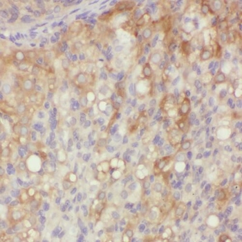 QDPR Rabbit Polyclonal Antibody