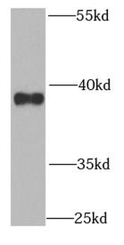 QKI Rabbit Polyclonal Antibody
