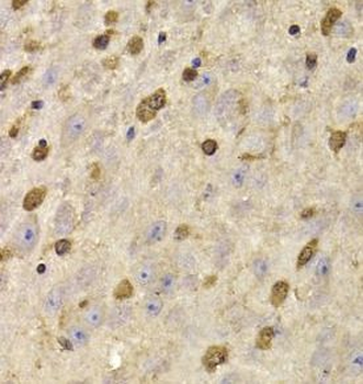 QKI Rabbit Polyclonal Antibody