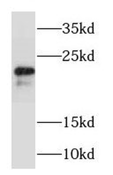 RAB22A Rabbit Polyclonal Antibody