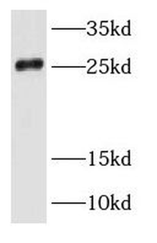 RAB35 Rabbit Polyclonal Antibody