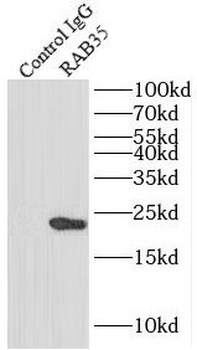 RAB35 Rabbit Polyclonal Antibody