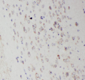 RAB35 Rabbit Polyclonal Antibody