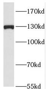 RAB3GAP1 Rabbit Polyclonal Antibody