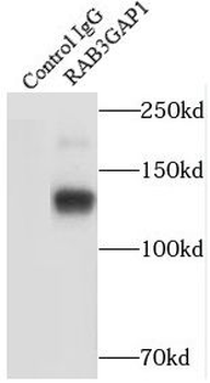 RAB3GAP1 Rabbit Polyclonal Antibody