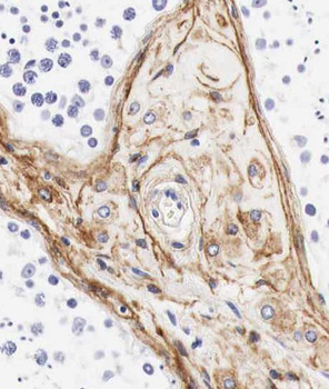 RAB3GAP1 Rabbit Polyclonal Antibody