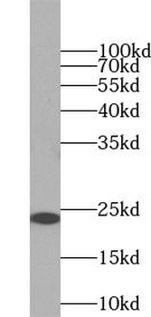 RAB5A Rabbit Polyclonal Antibody