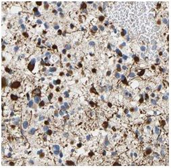 RAB5A Rabbit Polyclonal Antibody