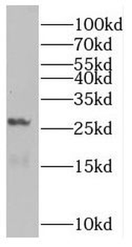 RAB5B Rabbit Polyclonal Antibody