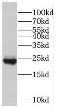 RAB7A Rabbit Polyclonal Antibody