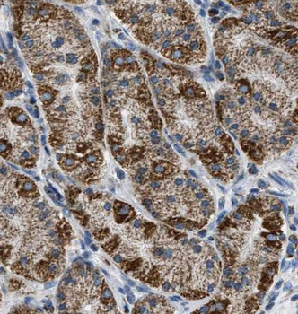 RAB7A Rabbit Polyclonal Antibody