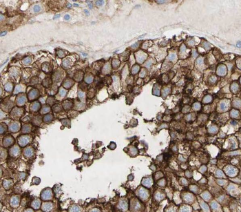 RBSN Rabbit Polyclonal Antibody