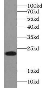 RAC1 Mouse Monoclonal Antibody