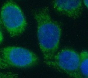 RAC1 Mouse Monoclonal Antibody