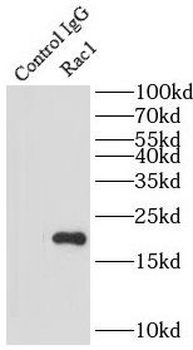 RAC1 Mouse Monoclonal Antibody