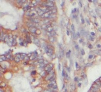 RAC1 Mouse Monoclonal Antibody