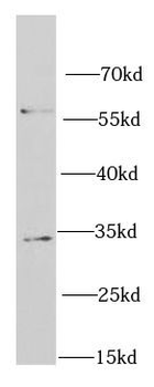 RACK1 Rabbit Polyclonal Antibody