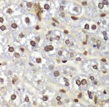 RACK1 Rabbit Polyclonal Antibody