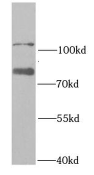 RAD18 Rabbit Polyclonal Antibody