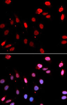 RAD18 Rabbit Polyclonal Antibody