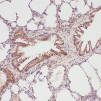 RAD18 Rabbit Polyclonal Antibody