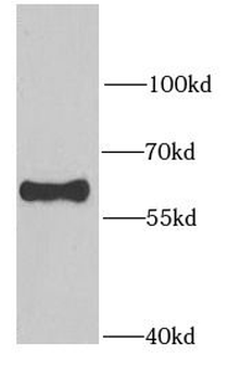 RAD23B Rabbit Polyclonal Antibody