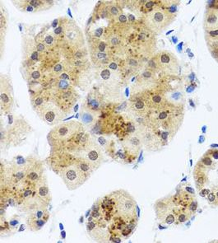 RAD23B Rabbit Polyclonal Antibody