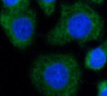 RDX Rabbit Polyclonal Antibody