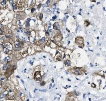 RDX Rabbit Polyclonal Antibody