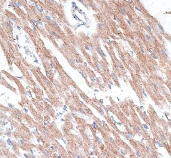 RAMP1 Rabbit Polyclonal Antibody