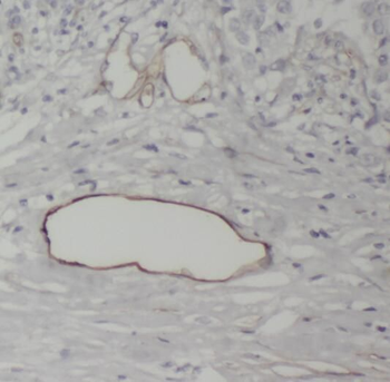 RAMP3 Rabbit Polyclonal Antibody