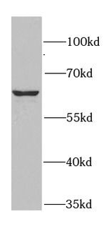 RANGAP1 Rabbit Polyclonal Antibody