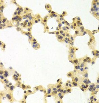 RANGAP1 Rabbit Polyclonal Antibody