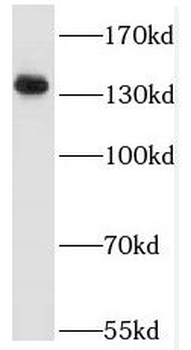 RPTOR Rabbit Polyclonal Antibody