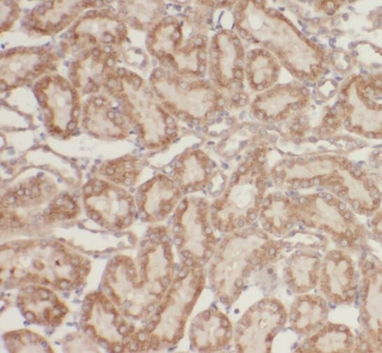 RPTOR Rabbit Polyclonal Antibody