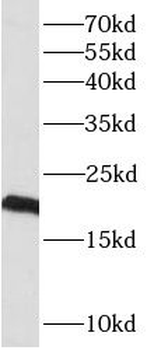 PLAAT4 Rabbit Polyclonal Antibody