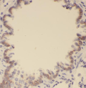 PLAAT4 Rabbit Polyclonal Antibody