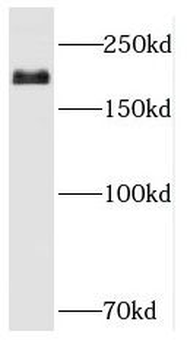 RBBP6 Rabbit Polyclonal Antibody