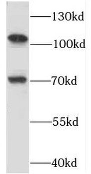 RBM15B Rabbit Polyclonal Antibody