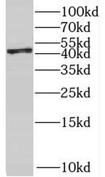 RBM17 Rabbit Polyclonal Antibody