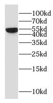 RBM22 Rabbit Polyclonal Antibody