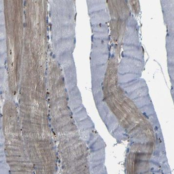 RBM24 Rabbit Polyclonal Antibody