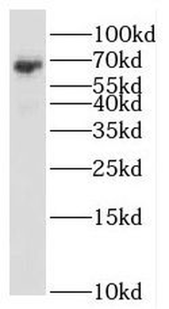 RBM47 Rabbit Polyclonal Antibody