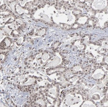 RBM6 Rabbit Polyclonal Antibody