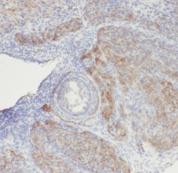 RBM8A Rabbit Polyclonal Antibody