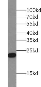 RBP4 Mouse Monoclonal Antibody