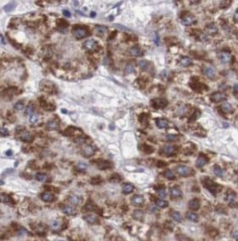 RBP4 Mouse Monoclonal Antibody