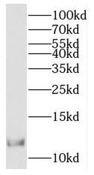 RBX1 Rabbit Polyclonal Antibody