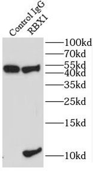 RBX1 Rabbit Polyclonal Antibody